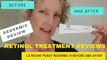 Retinol Treatment Reviews