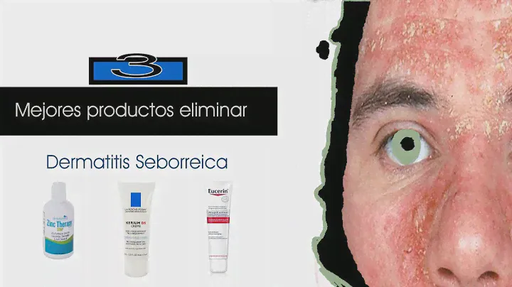 3 Mejores productos que frenan la dermatitis seborreica